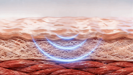 Illustration of vibration acting below the skin